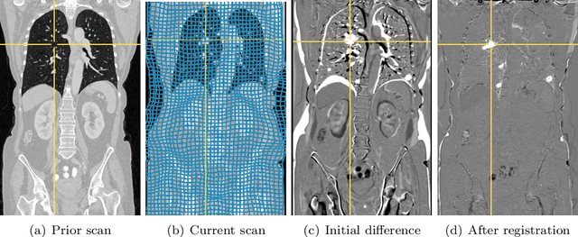 Figure 1 for A matrix-free approach to parallel and memory-efficient deformable image registration