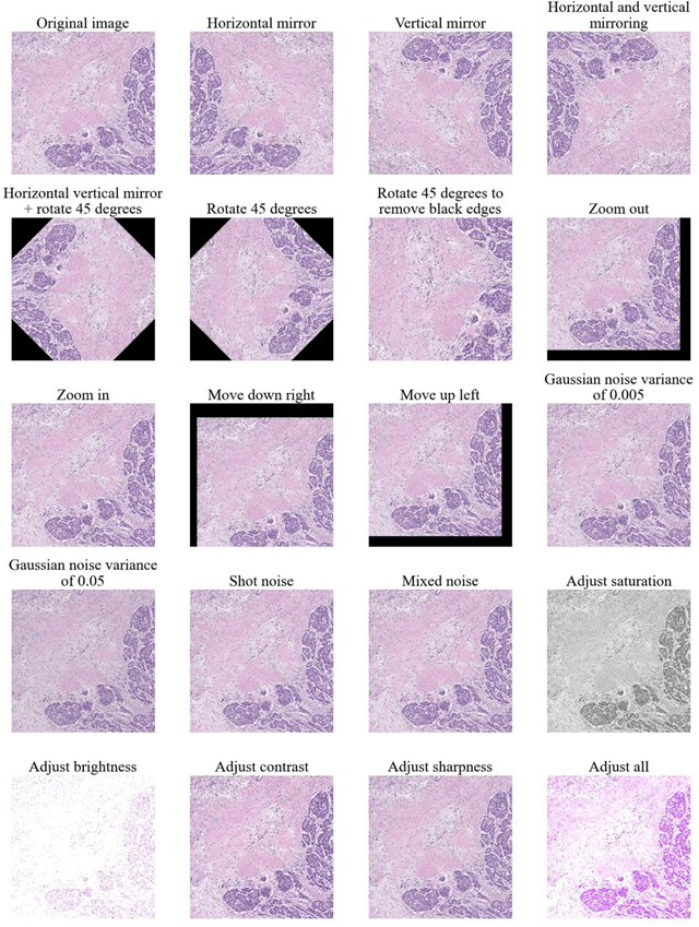 Figure 4 for A review of machine learning approaches, challenges and prospects for computational tumor pathology