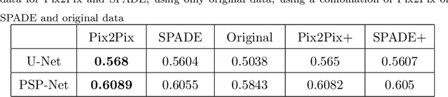 Figure 2 for Implanting Synthetic Lesions for Improving Liver Lesion Segmentation in CT Exams