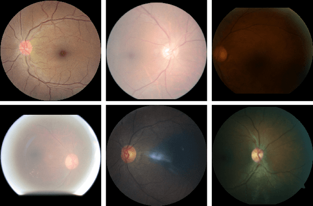 Figure 1 for Retinal Image Restoration and Vessel Segmentation using Modified Cycle-CBAM and CBAM-UNet