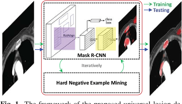 Figure 1 for ULDor: A Universal Lesion Detector for CT Scans with Pseudo Masks and Hard Negative Example Mining