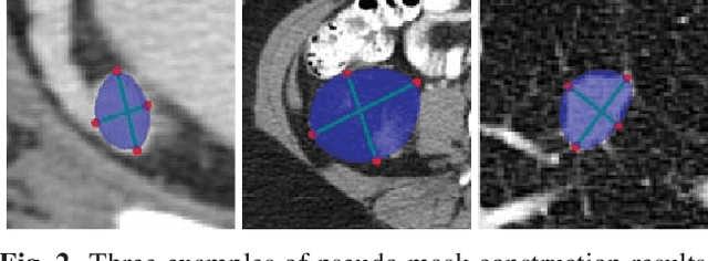 Figure 3 for ULDor: A Universal Lesion Detector for CT Scans with Pseudo Masks and Hard Negative Example Mining
