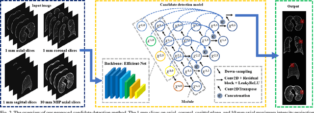 Figure 2 for Efficient convolutional neural networks for multi-planar lung nodule detection: improvement on small nodule identification