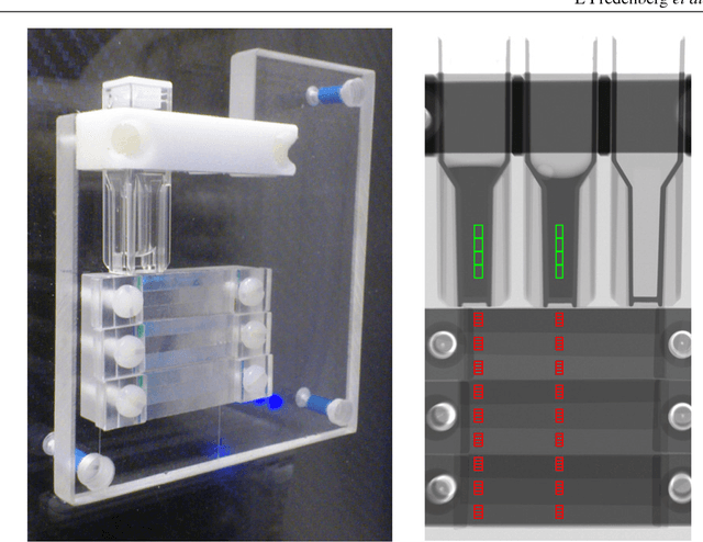 Figure 3 for Measurement of breast-tissue x-ray attenuation by spectral mammography: first results on cyst fluid