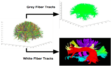Figure 1 for Siamese LSTM based Fiber Structural Similarity Network (FS2Net) for Rotation Invariant Brain Tractography Segmentation