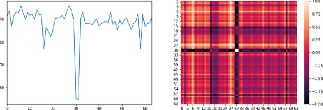 Figure 3 for NVAE-GAN Based Approach for Unsupervised Time Series Anomaly Detection