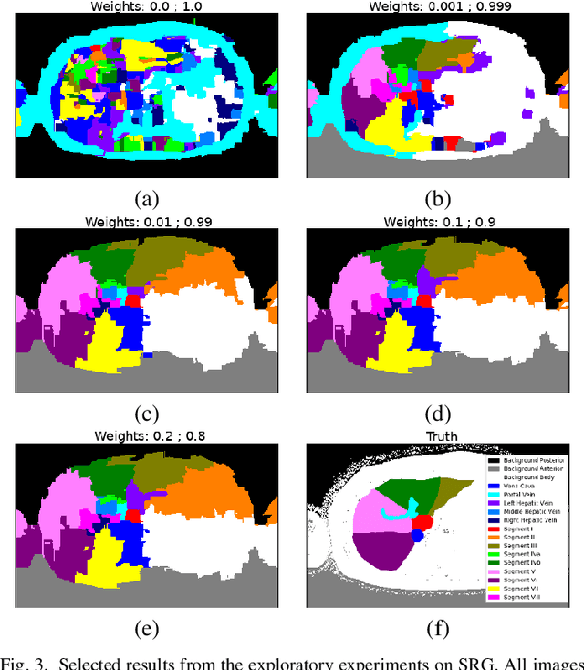 Figure 3 for A Structural Graph-Based Method for MRI Analysis