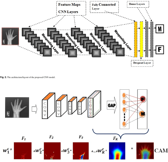 Figure 3 for Child Gender Determination with Convolutional Neural Networks on Hand Radio-Graphs