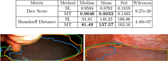 Figure 2 for More unlabelled data or label more data? A study on semi-supervised laparoscopic image segmentation
