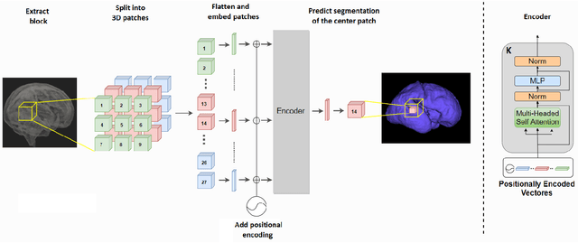 Figure 1 for Convolution-Free Medical Image Segmentation using Transformers