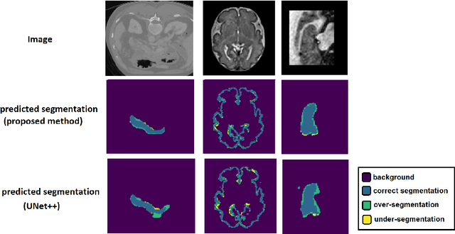 Figure 2 for Convolution-Free Medical Image Segmentation using Transformers