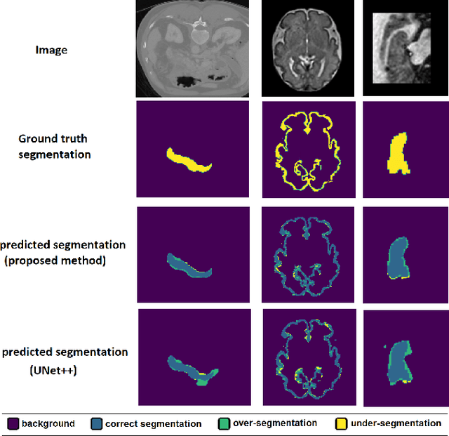 Figure 3 for Convolution-Free Medical Image Segmentation using Transformers