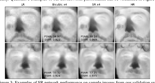 Figure 4 for Recurrent Super-Resolution Method for Enhancing Low Quality Thermal Facial Data