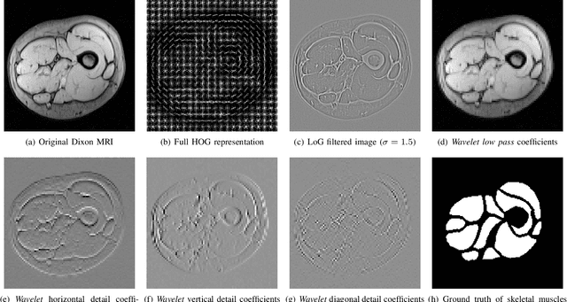Figure 1 for Segmentation of Skeletal Muscle in Thigh Dixon MRI Based on Texture Analysis