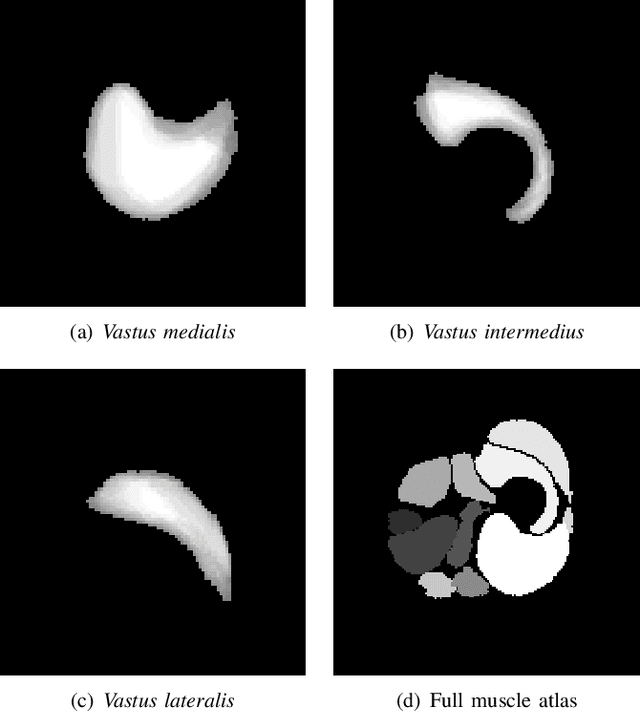 Figure 2 for Segmentation of Skeletal Muscle in Thigh Dixon MRI Based on Texture Analysis