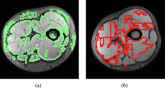 Figure 4 for Segmentation of Skeletal Muscle in Thigh Dixon MRI Based on Texture Analysis