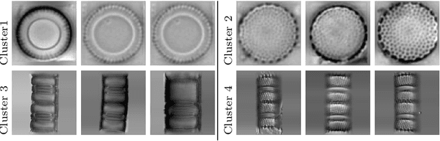 Figure 3 for Tackling Inter-Class Similarity and Intra-Class Variance for Microscopic Image-based Classification