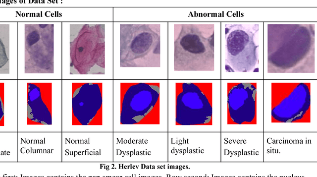 Figure 1 for Algorithms for screening of Cervical Cancer: A chronological review