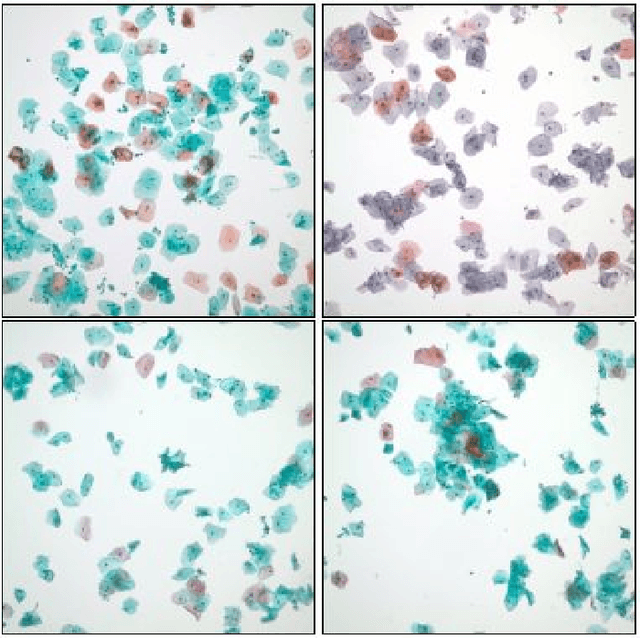 Figure 2 for Algorithms for screening of Cervical Cancer: A chronological review