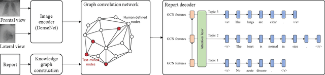 Figure 3 for Prior Knowledge Enhances Radiology Report Generation