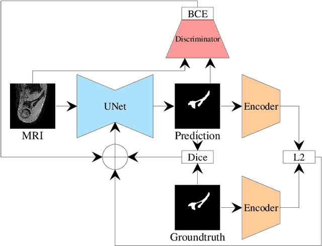 Figure 1 for Combining Shape Priors with Conditional Adversarial Networks for Improved Scapula Segmentation in MR images
