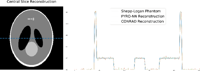 Figure 4 for PYRO-NN: Python Reconstruction Operators in Neural Networks