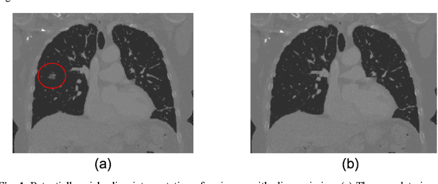 Figure 1 for Technical Report: Quality Assessment Tool for Machine Learning with Clinical CT