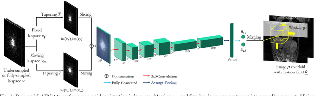 Figure 1 for LAPNet: Non-rigid Registration derived in k-space for Magnetic Resonance Imaging