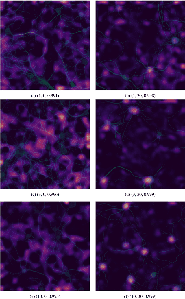 Figure 2 for Deep Learning for Estimating Synaptic Health of Primary Neuronal Cell Culture