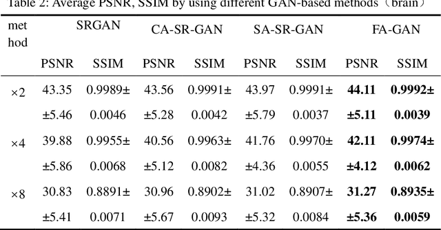 Figure 4 for FA-GAN: Fused Attentive Generative Adversarial Networks for MRI Image Super-Resolution