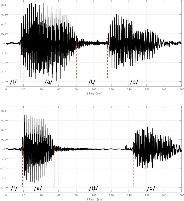 Figure 1 for Lexical and syntactic gemination in Italian consonants -- Does a geminate Italian consonant consist of a repeated or a strengthened consonant?