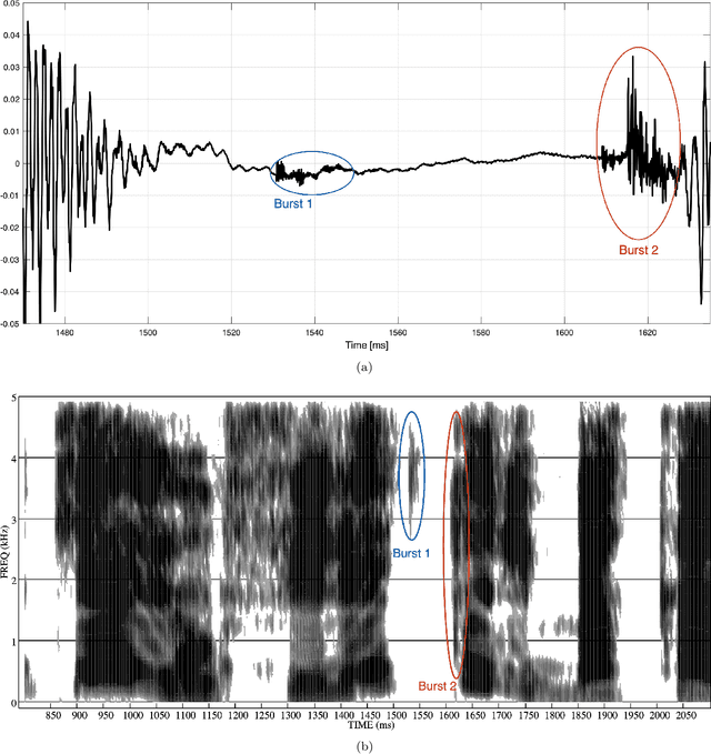 Figure 2 for Lexical and syntactic gemination in Italian consonants -- Does a geminate Italian consonant consist of a repeated or a strengthened consonant?