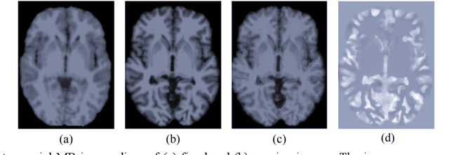 Figure 1 for Enhancing Medical Image Registration via Appearance Adjustment Networks