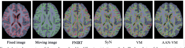 Figure 4 for Enhancing Medical Image Registration via Appearance Adjustment Networks