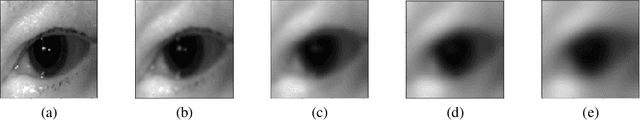 Figure 3 for Towards Privacy-preserving Explanations in Medical Image Analysis