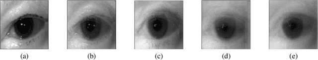 Figure 4 for Towards Privacy-preserving Explanations in Medical Image Analysis