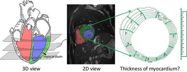 Figure 1 for Measure Anatomical Thickness from Cardiac MRI with Deep Neural Networks