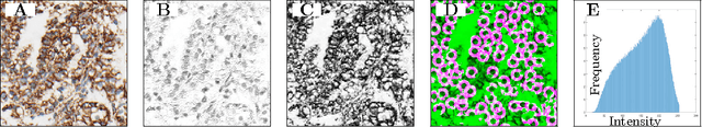 Figure 3 for Mitochondria-based Renal Cell Carcinoma Subtyping: Learning from Deep vs. Flat Feature Representations