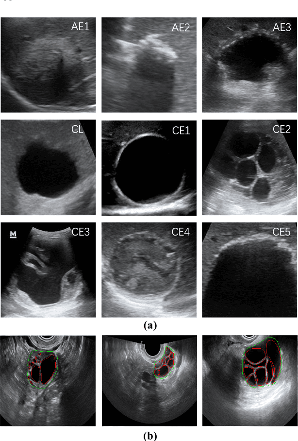 Figure 1 for HASA: Hybrid Architecture Search with Aggregation Strategy for Echinococcosis Classification and Ovary Segmentation in Ultrasound Images