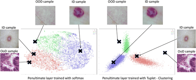 Figure 3 for Out of distribution detection for skin and malaria images