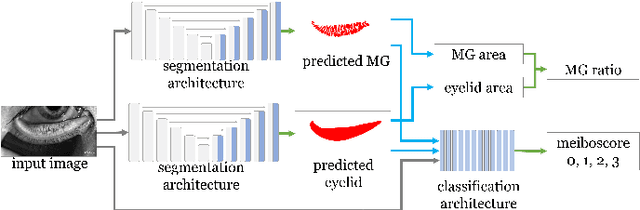 Figure 2 for AI-based automated Meibomian gland segmentation, classification and reflection correction in infrared Meibography