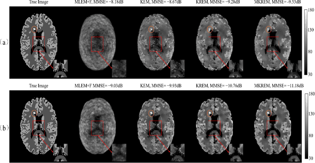 Figure 3 for PET Image Reconstruction with Multiple Kernels and Multiple Kernel Space Regularizers