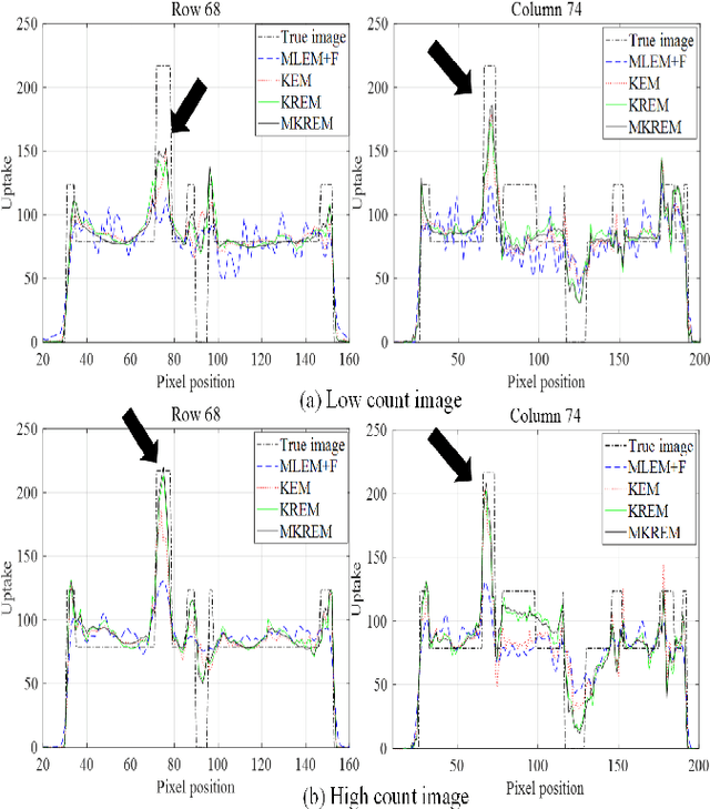 Figure 4 for PET Image Reconstruction with Multiple Kernels and Multiple Kernel Space Regularizers