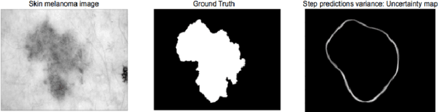 Figure 1 for Cost-Effective Active Learning for Melanoma Segmentation