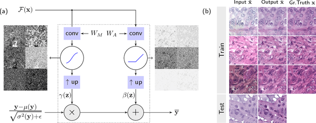 Figure 2 for Context-based Normalization of Histological Stains using Deep Convolutional Features