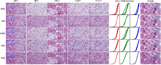 Figure 4 for Context-based Normalization of Histological Stains using Deep Convolutional Features