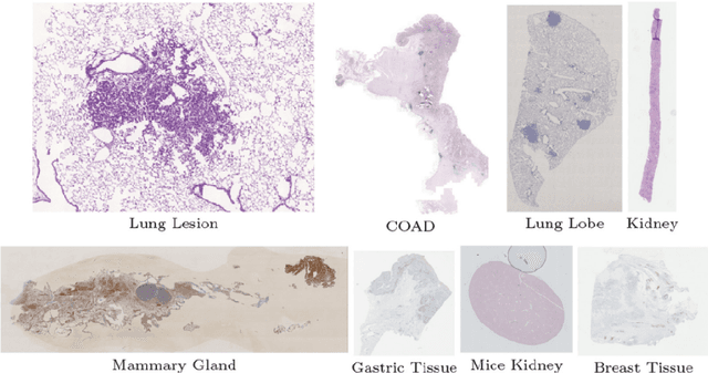 Figure 1 for A Hybrid Deep Feature-Based Deformable Image Registration Method for Pathological Images