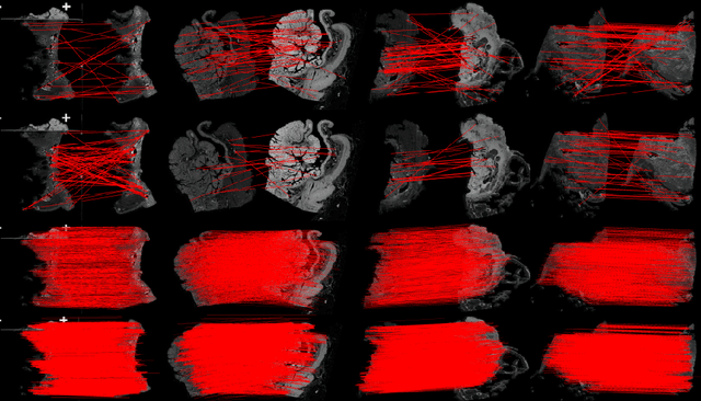 Figure 3 for A Hybrid Deep Feature-Based Deformable Image Registration Method for Pathological Images