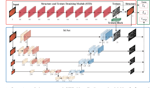 Figure 1 for Retinal Image Segmentation with a Structure-Texture Demixing Network