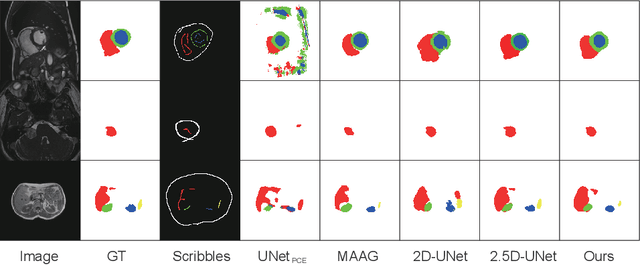 Figure 3 for Scribble2D5: Weakly-Supervised Volumetric Image Segmentation via Scribble Annotations